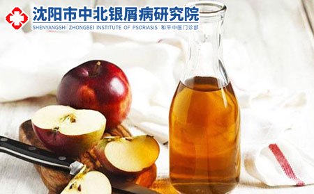 牛皮肤癣,牛皮肤癣复发,预防牛皮肤癣,牛皮肤癣护理