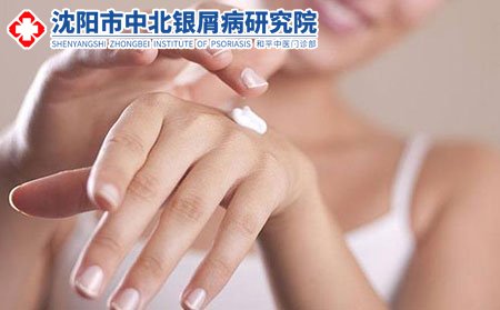 沈阳哪家牛皮癣专科医院,沈阳专门治疗牛皮癣