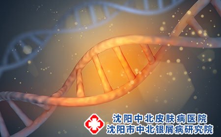 沈阳中北银屑病研究院正不正规啊