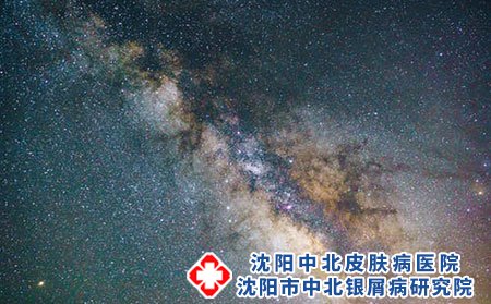 沈阳哪里治银屑病-如何避免银屑病复发