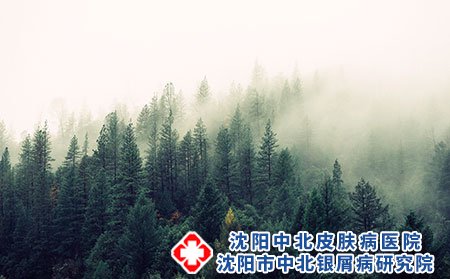 成人和儿童牛皮癣有什么不同?不能滥用激素!