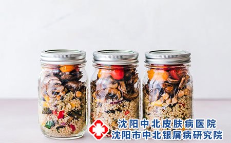 牛皮癣患者吃什么比较好呢?冬季火锅禁忌?