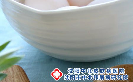 牛皮癣患者日常洗澡应该注意什么?