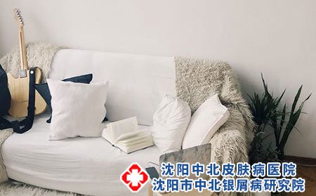 头面部牛皮癣的病因是什么?吃什么比较好?