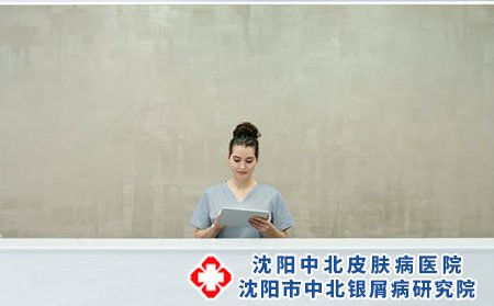 女性牛皮癣患者怀孕应该注意什么?如何预防?