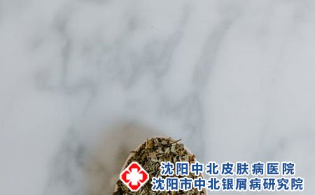 青少年牛皮癣患者应该注意些什么?