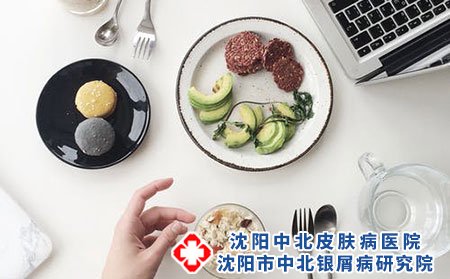 牛皮癣饮食方面要注意什么?如何减少皮损瘙痒?